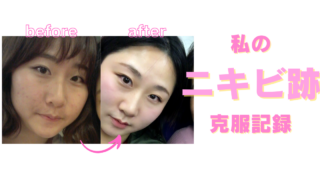 nikibi