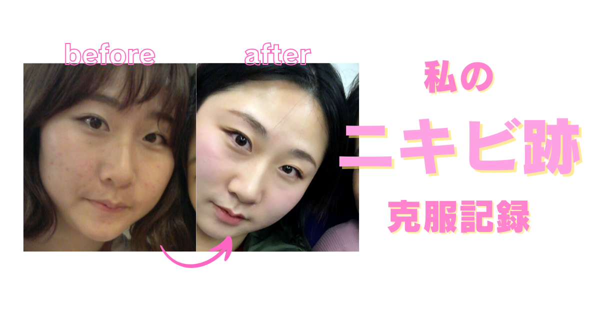 nikibi